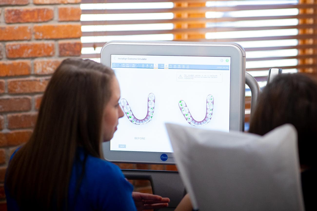 HWH Technology New 1 1 - How Rubber Bands for Braces Can Improve Your Smile