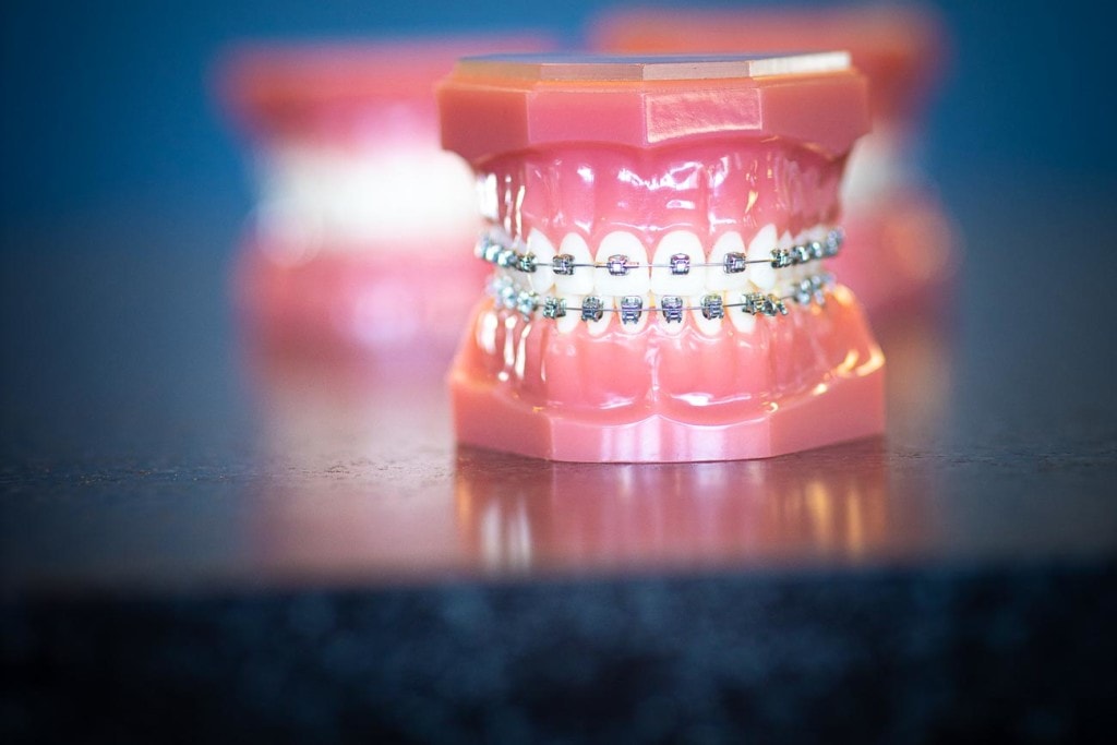 Your Orthodontic Options | Topeka Orthodontist - WH Orthodontics - Your Orthodontic Options | Topeka Orthodontist - WH Orthodontics