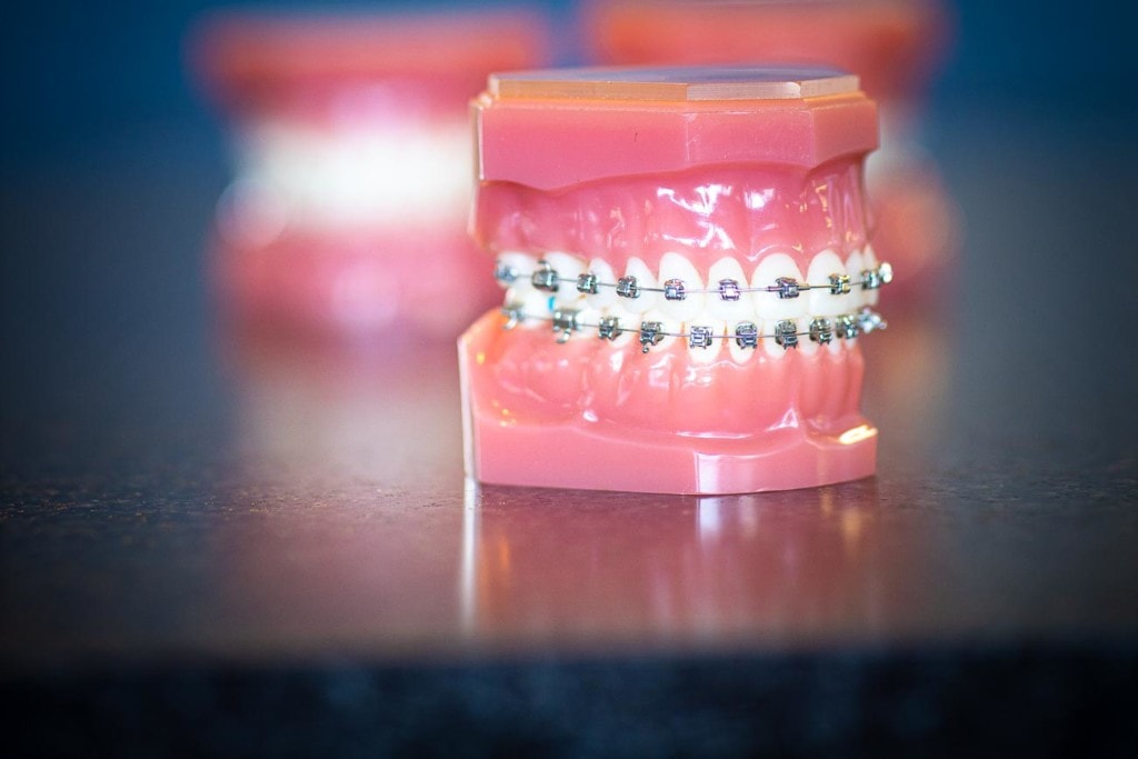 Your Orthodontic Options | Topeka Orthodontist - WH Orthodontics - Your Orthodontic Options | Topeka Orthodontist - WH Orthodontics