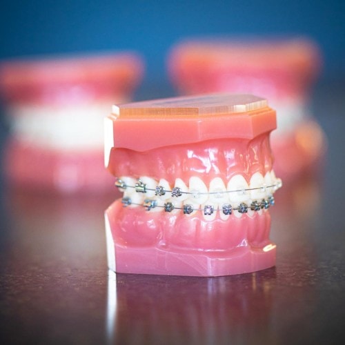 HWH Technology New 8 500x500 - Clear Braces & Ceramic Braces | Topeka Orthodontist - WH Orthodontics