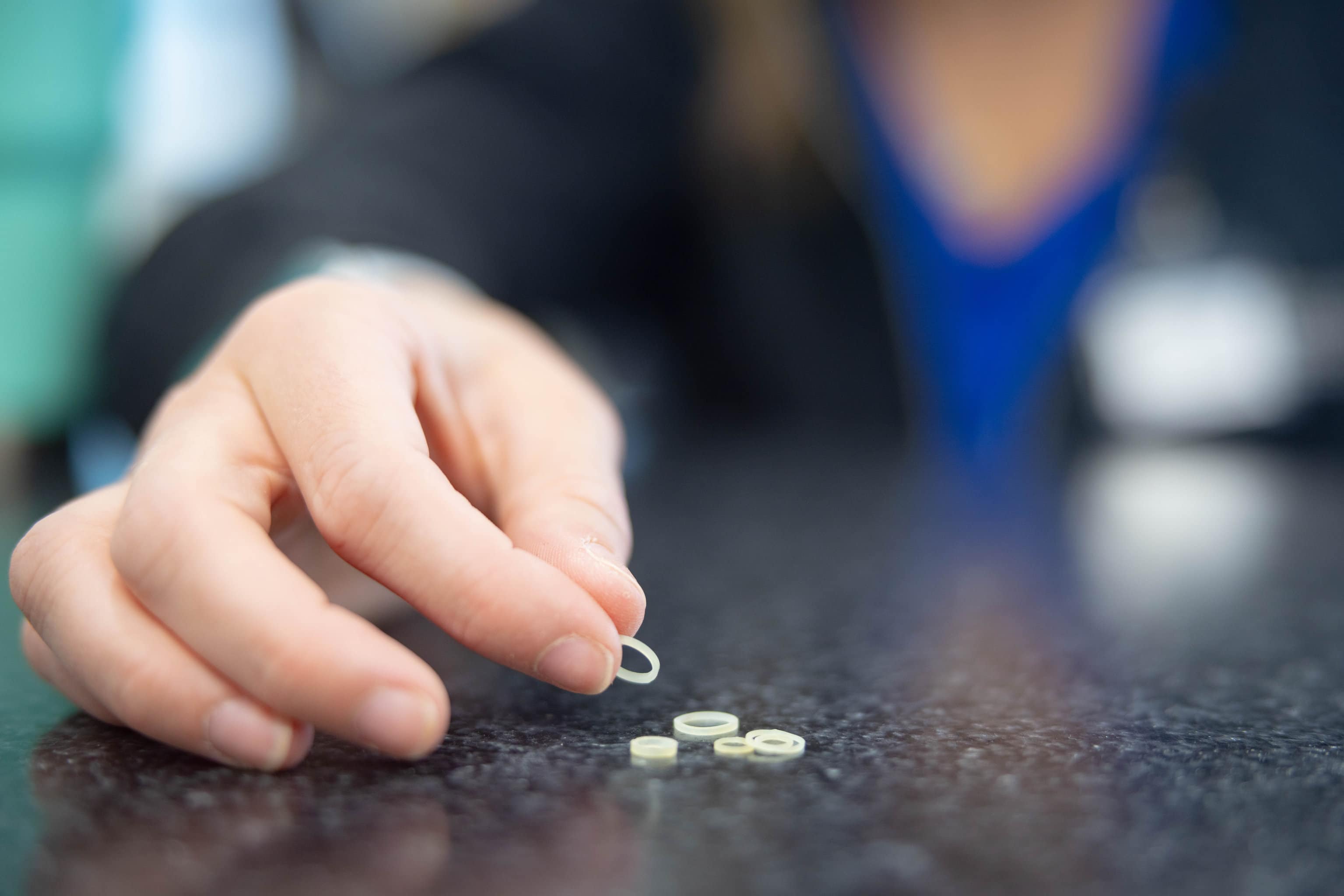 How Rubber Bands for Braces Can Improve Your Smile