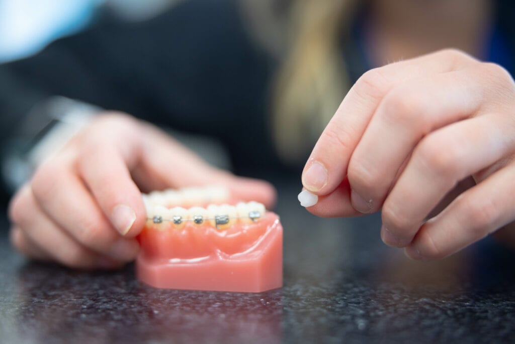 Braces & Invisalign in Topeka, KS | WH Orthodontics - Braces & Invisalign in Topeka, KS | WH Orthodontics