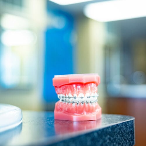 Office Branding Accessories HWH Orthodontics Hamilton Wilson Hendrickson Topeka KS 2023 49 500x500 - Advanced Metal Braces | Topeka Orthodontist - WH Orthodontics