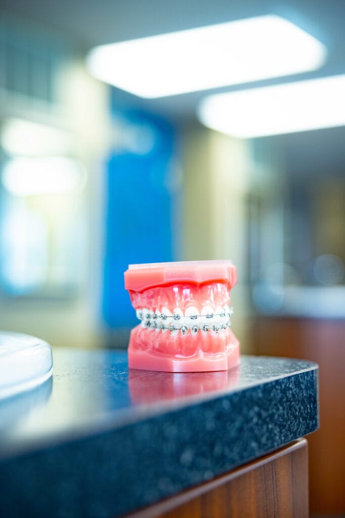 Opciones De Ortodoncia | Topeka Ortodoncista - WH Orthodontics - Opciones De Ortodoncia | Topeka Ortodoncista - WH Orthodontics