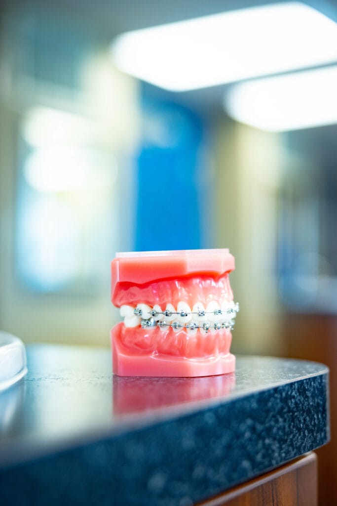 Advanced Metal Braces | Topeka Orthodontist - WH Orthodontics - Advanced Metal Braces | Topeka Orthodontist - WH Orthodontics