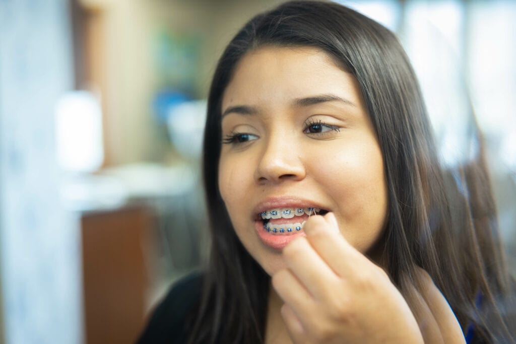 Patient Candids HWH Orthodontics Hamilton Wilson Hendrickson Topeka KS 2023 154 1024x683 - Rubber Bands for Braces: How to Put Elastics on Correctly