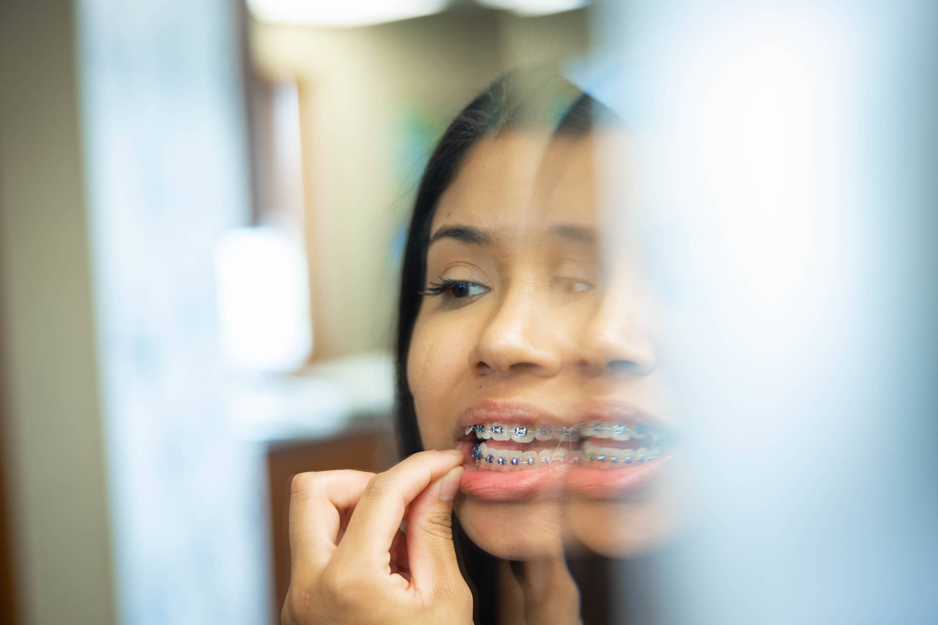 Patient Candids HWH Orthodontics Hamilton Wilson Hendrickson Topeka KS 2023 156 - Bite Turbos: Saving Your Braces and Helping Your Smile