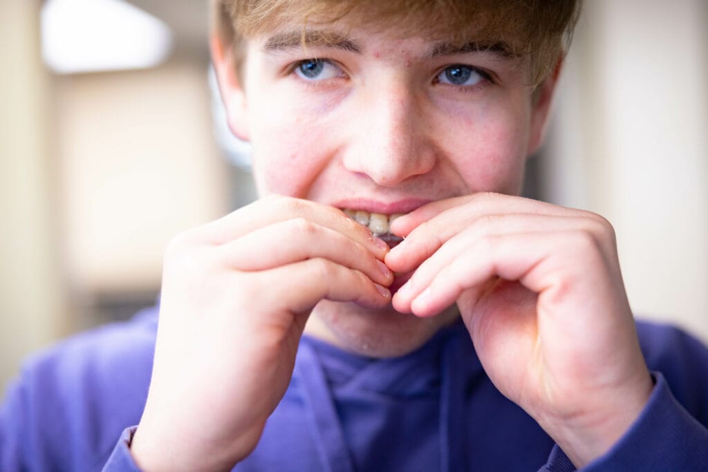 Patient Candids HWH Orthodontics Hamilton Wilson Hendrickson Topeka KS 2023 342 1024x683 - Can I Get Invisalign If I Grind My Teeth? We Can Help!