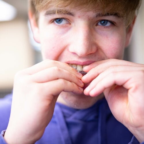 invisalign treatment topeka ks