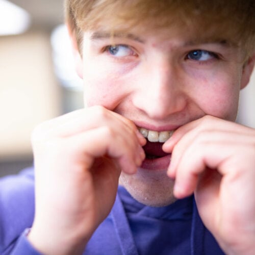 invisalign fixing teeth topeka ks